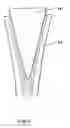 Fig. 02 - Joint prosthesis