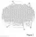 Fig. 02 - Bone implant with a surface anchoring structure