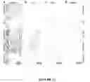 Fig. 12 - Reversible siRNA-based silencing of mutant and endogenous wild-type huntingtin gene and its application for the treatment of Huntington's disease