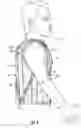 Fig. 07 - Patient assistance device