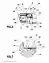 Fig. 06 - Cleaning apparatus with fastening device