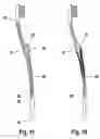 Fig. 09 - DEVICE FOR CLEANING TEETH AND/OR MOUTH