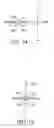 Fig. 09 - Measurement of micromovements