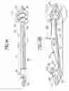 Fig. 02 - Multi-cage spacer