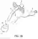 Fig. 03 - Tracheostomy Tube