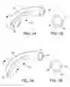 Fig. 04 - Tracheostomy Tube