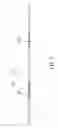 Fig. 05 - Canopy device