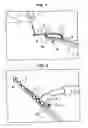 Fig. 02 - Production method of orthodontic bracket with positioning guide