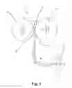 Fig. 02 - Casting roll for a two-roll casting device and two-roll casting device