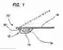 Fig. 02 - HYDROGEL CONTACT LENSES AND PACKAGE SYSTEMS AND PRODUCTION METHODS FOR SAME