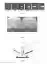 Fig. 02 - METHOD FOR LASER ABLATION