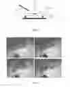Fig. 06 - METHOD FOR LASER ABLATION