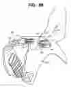 Fig. 06 - Golf bag or other shoulder-borne device having double strap to single strap convertibility