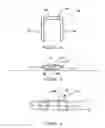 Fig. 03 - Multiple coil staple and staple applier