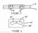 Fig. 04 - Multiple coil staple and staple applier