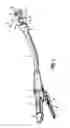 Fig. 02 - Surgical instrument and method for performing a resection