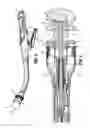 Fig. 07 - Surgical instrument and method for performing a resection
