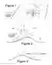 Fig. 02 - Aerodynamic structure with asymmetrical shock bump