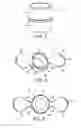 Fig. 02 - Article and method for fabricating an applicator tip assembly for a skin formulation applicator