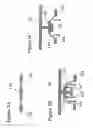 Fig. 09 - Balancing pressure to improve a fluid seal