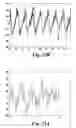 Fig. 18 - Detection of rotor side anomaly in an induction machine