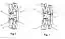 Fig. 04 - Wrist watch including a reversibility device