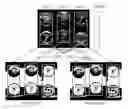Fig. 01 - Inter-Frame Motion Detection