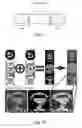 Fig. 08 - Inter-Frame Motion Detection