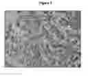 Fig. 08 - METHODS FOR THE DETECTION AND QUANTITATION OF PTEN