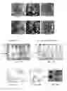 Fig. 07 - Expression of Human Serum Albumin in Plastids