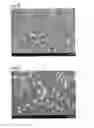 Fig. 17 - ETCHING METHOD AND METHOD FOR MANUFACTURING OPTICAL/ELECTRONIC DEVICE USING THE SAME