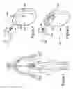 Fig. 02 - Connector assemblies and contacts for implantable medical electrical systems