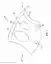 Fig. 05 - Arrowhead having blades offset rearward from the tip