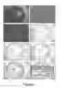 Fig. 02 - Pharmaceutical composition for preventing, stabilising and/or inhibiting blood and lymph vascularization