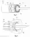 Fig. 07 - Systems and methods for making and using image-guided intravascular and endocardial therapy systems