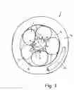 Fig. 02 - Controllable stiffness catheter guide device