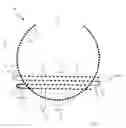 Fig. 03 - System for ophthalmic laser surgery