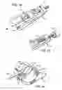 Fig. 02 - Surgical cable tensioning system