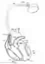 Fig. 01 - System and method for detecting pulmonary edema based on impedance measured using an implantable medical device during a lead maturation interval