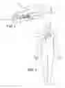 Fig. 02 - Implantable medical device with exposed generator