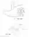 Fig. 20 - Gastric Simulation Anchor and Method