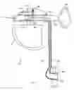 Fig. 24 - Gastric Simulation Anchor and Method
