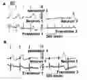 Fig. 01 - Neural device using at least one nano-wire