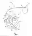 Fig. 02 - TIP ASSEMBLY FOR MEDICAL ELECTRICAL LEAD