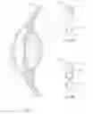 Fig. 02 - Devices, Systems and Methods for Treating an Eye