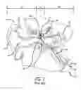 Fig. 02 - System and method for treatment of non-ventilating middle ear by providing a gas pathway through the nasopharynx