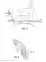 Fig. 08 - System and method for treatment of non-ventilating middle ear by providing a gas pathway through the nasopharynx