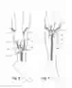 Fig. 08 - Device for opening and closing a zipper