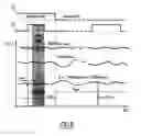 Fig. 06 - METHOD FOR DIAGNOSING THE BYPASS FLAP OF AN EXCHANGER IN AN EXHAUST GAS RECIRCULATION SYSTEM