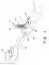 Fig. 03 - Electronic torque wrench